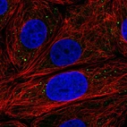 Immunofluorescent staining of human cell line MCF7 shows localization to cytoplasmic bodies.