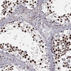 Anti-REXO5 Antibody