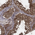 Anti-MIER2 Antibody