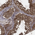 Anti-MIER2 Antibody