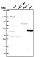 Anti-LDHD Antibody