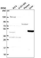Anti-LDHD Antibody
