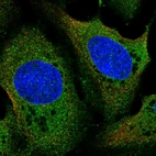 Immunofluorescent staining of human cell line U-2 OS shows localization to cytosol.