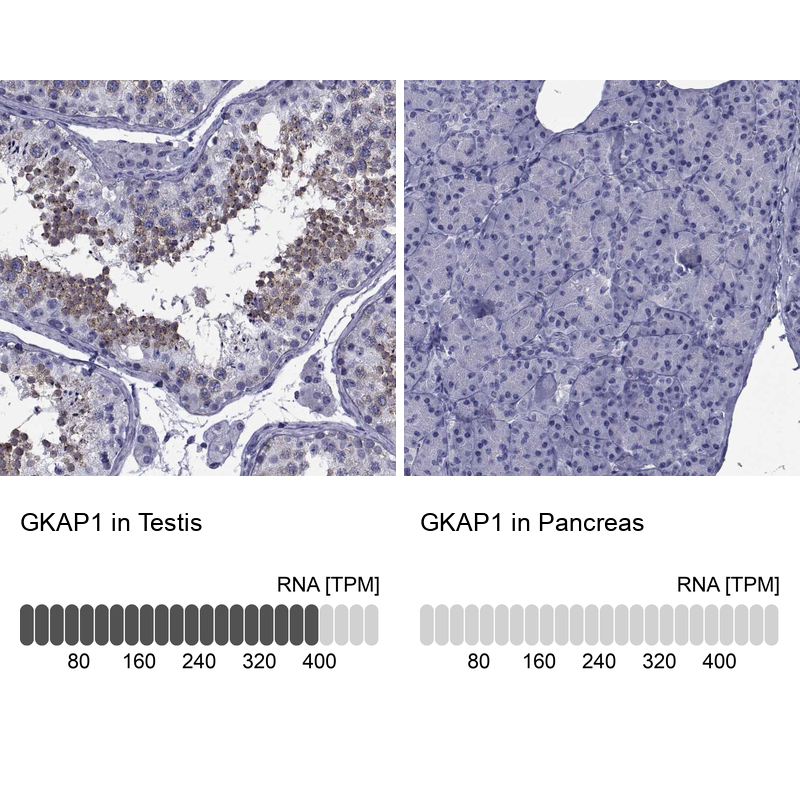Anti-GKAP1 Antibody