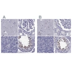 Immunohistochemical staining of human cerebral cortex, kidney, pancreas and testis using Anti-GKAP1 antibody HPA066173 (A) shows similar protein distribution across tissues to independent antibody HPA035118 (B).