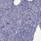 Immunohistochemical staining of human pancreas shows low expression as expected.