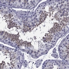 Immunohistochemical staining of human testis shows high expression.