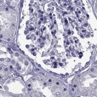 Immunohistochemical staining of human kidney using Anti-GKAP1 antibody HPA066173.