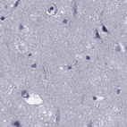 Immunohistochemical staining of human cerebral cortex using Anti-GKAP1 antibody HPA066173.