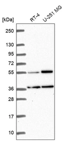 Western blot analysis in human cell line RT-4 and human cell line U-251 MG.