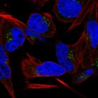 Immunofluorescent staining of human cell line RH-30 shows localization to the Golgi apparatus.