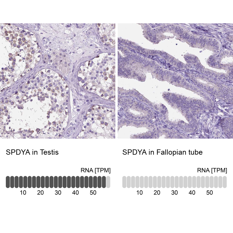Anti-SPDYA Antibody