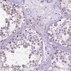 Immunohistochemical staining of human testis shows high expression.