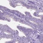Immunohistochemical staining of human fallopian tube shows low expression as expected.