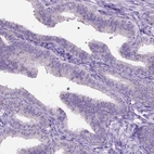 Immunohistochemical staining of human fallopian tube shows low expression as expected.