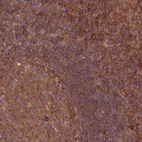 Anti-EIF3D Antibody