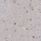 Anti-WASF3 Antibody