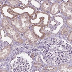 Immunohistochemical staining of human kidney shows high expression.