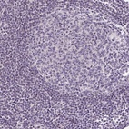 Anti-SLC2A9 Antibody