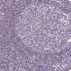 Immunohistochemical staining of human lymph node shows low expression as expected.