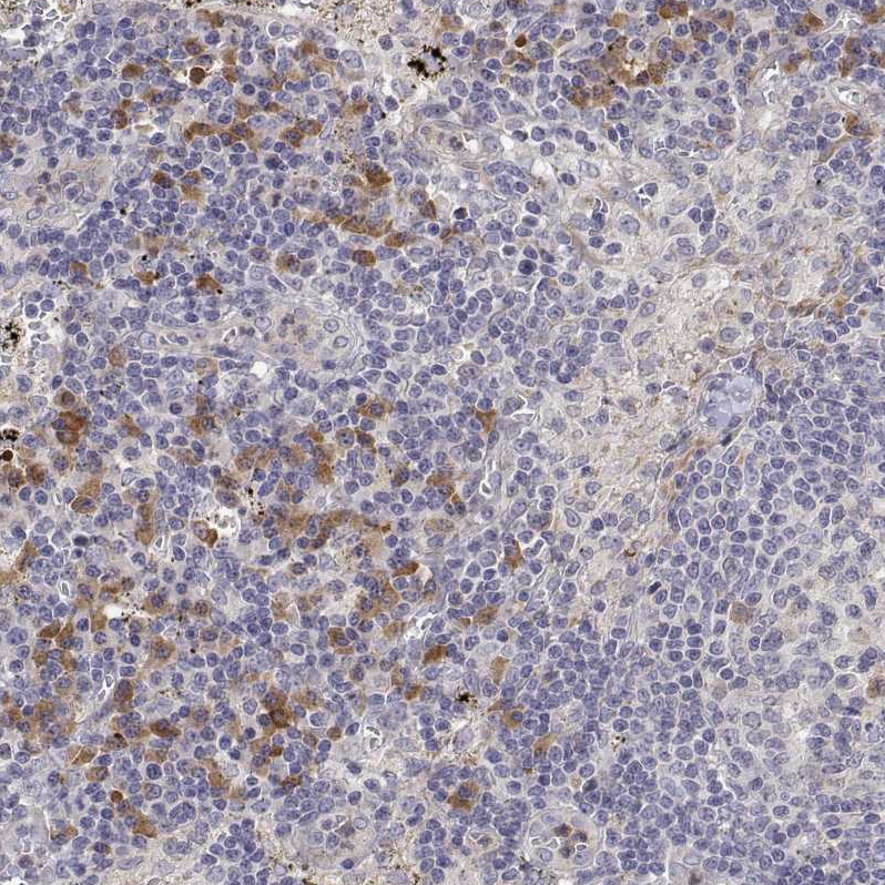 Anti-IGFBP4 Antibody