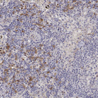 Anti-IGFBP4 Antibody