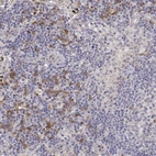 Anti-IGFBP4 Antibody