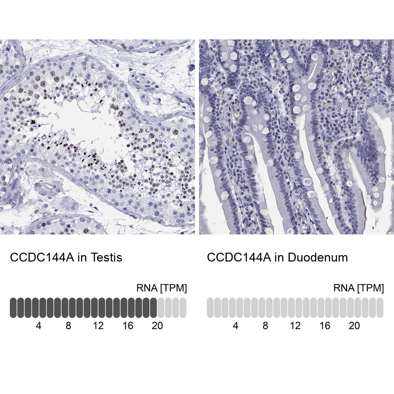 Anti-CCDC144A Antibody