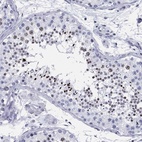 Immunohistochemical staining of human testis shows high expression.