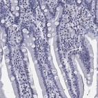 Immunohistochemical staining of human duodenum shows low expression as expected.