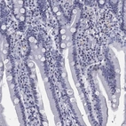Immunohistochemical staining of human duodenum shows low expression as expected.