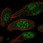Anti-TEAD2 Antibody