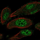 Anti-TEAD2 Antibody
