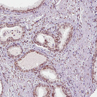 Anti-EMD Antibody