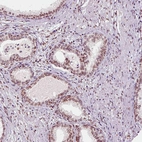 Immunohistochemical staining of human prostate shows moderate nuclear membrane positivity in in glandular cells.