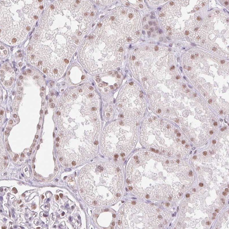 Anti-RPRD1B Antibody