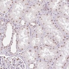 Anti-RPRD1B Antibody