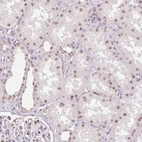 Anti-RPRD1B Antibody