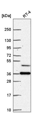 Western blot analysis in human cell line RT-4.