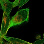 Immunofluorescent staining of human cell line RH-30 shows localization to cytosol & centrosome.