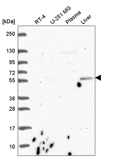 Anti-CDK5RAP1 Antibody