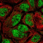 Immunofluorescent staining of human cell line CACO-2 shows localization to nuclear speckles & mitochondria.