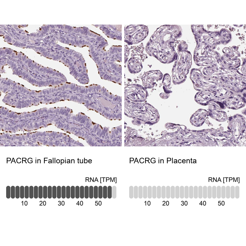 Anti-PACRG Antibody