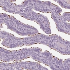 Immunohistochemical staining of human fallopian tube shows high expression.