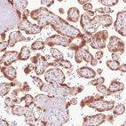 Anti-EMD Antibody