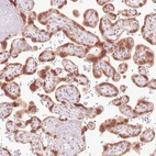 Immunohistochemical staining of human placenta shows moderate nuclear membrane positivity in in trophoblastic cells.