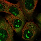 Immunofluorescent staining of human cell line U-2 OS shows localization to nucleoli & cytosol.