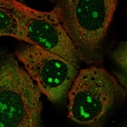 Immunofluorescent staining of human cell line U-2 OS shows localization to nucleoli & cytosol.