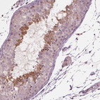 Immunohistochemical staining of human testis shows moderate positivity in a subset of cells in seminiferous ducts.