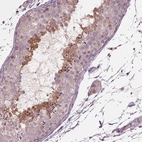 Immunohistochemical staining of human testis shows moderate positivity in a subset of cells in seminiferous ducts.
